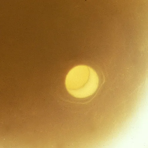 Microscope view of a pearl cross-section with a round center and surrounding nacre